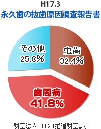 永久歯の抜歯原因調査報告